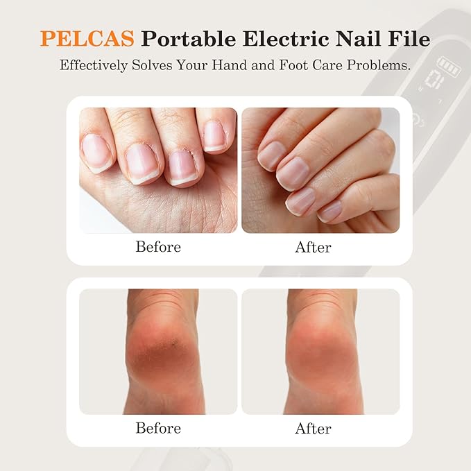 PELCAS Electric Nail Drills, Professional Cordless Nail File Kit with Light, 10 Speeds Manicure &amp; Pedicure Kit for Human, Pet, Thick Toenails, Natural &amp; Acrylic Nails Grey