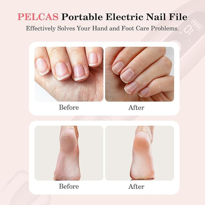 PELCAS Electric Nail File, 10 Speeds Cordless Nail Drill Kit with LED Light, Professional Nail Grinder with LCD Screen Portable e File for Human, Pet, Thick Toenails, Natural &amp; Acrylic Nails Pink
