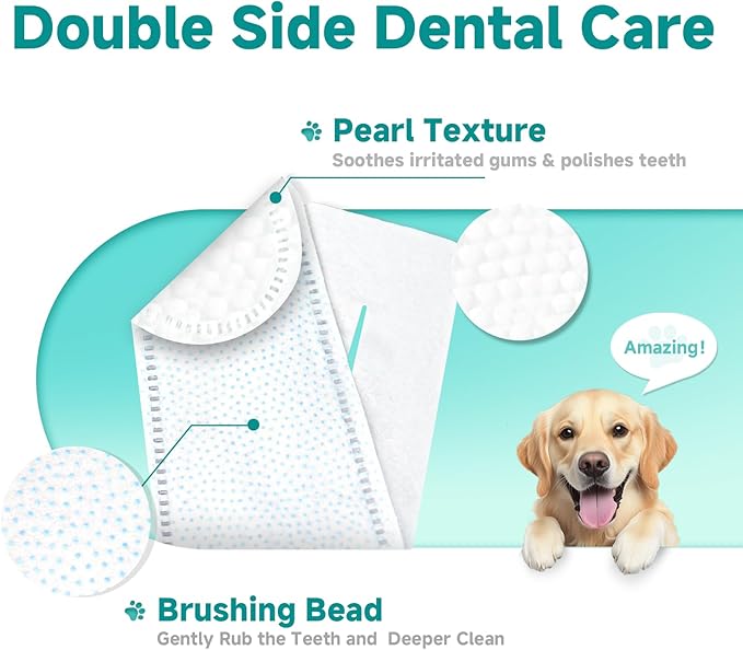 Pet Dental Finger Wipes for Dogs &amp; Cats, Dog Teeth Cleaning Wipes Tooth Brushing Kit by Remove Plaque and Tartar &amp; Freshens Breath Buildup No-Rinse Dog Finger Toothbrush