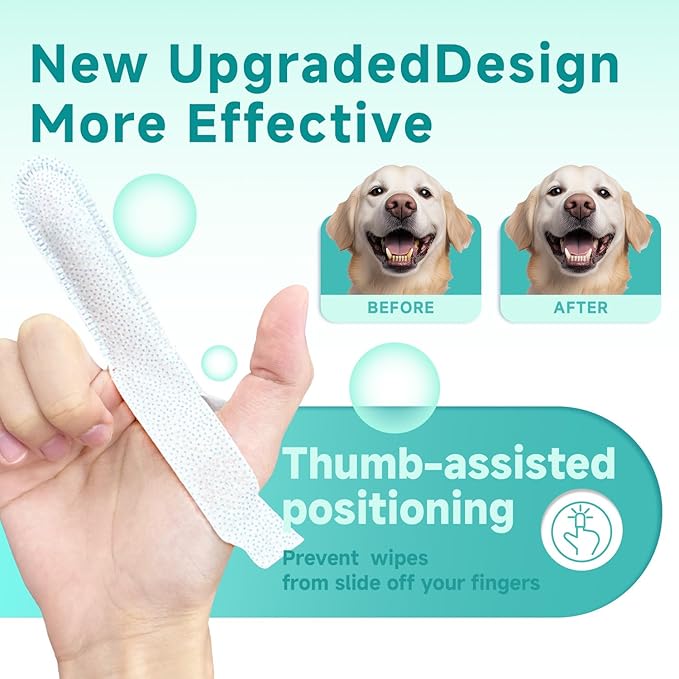 Pet Dental Finger Wipes for Dogs &amp; Cats, Dog Teeth Cleaning Wipes Tooth Brushing Kit by Remove Plaque and Tartar &amp; Freshens Breath Buildup No-Rinse Dog Finger Toothbrush